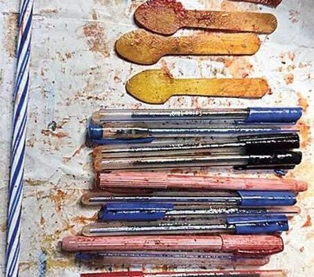 நெஞ்சு வலியால் துடித்த பெண் : வயிற்றிலிருந்தை கண்டு அதிர்ந்த மருத்துவர்கள்